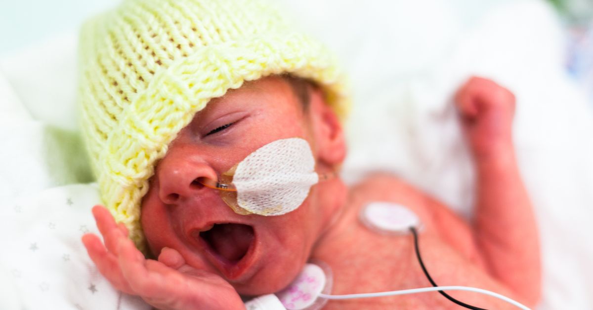 Fotografija prevremeno rođene bebe sa žutom kapicom