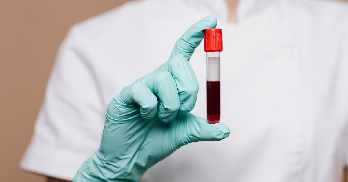Epruveta krv medicina